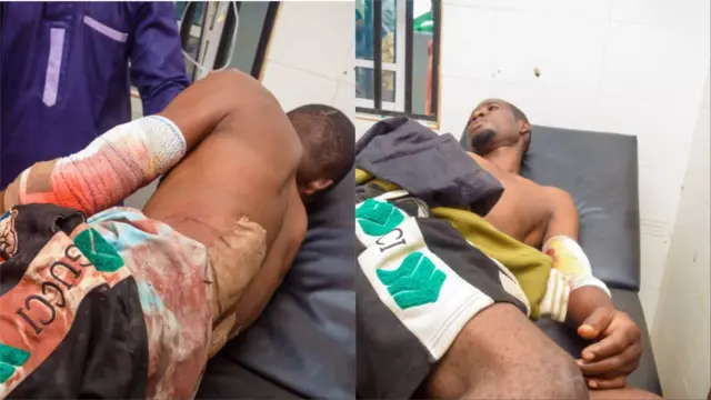 Aworan awọn eeyan meji kan to faragbọgbẹ. wọn wa ni ori ibusun ni ile iwosan kan.