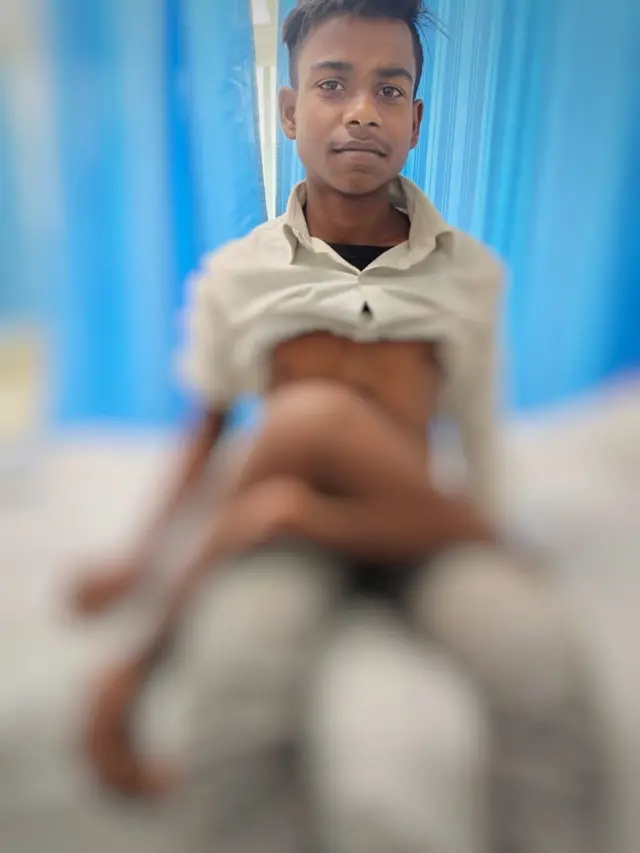 सर्जरी से पहले मोहित कुमार की तस्वीर.