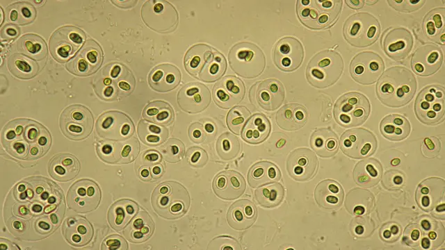 Cianobacterias. 