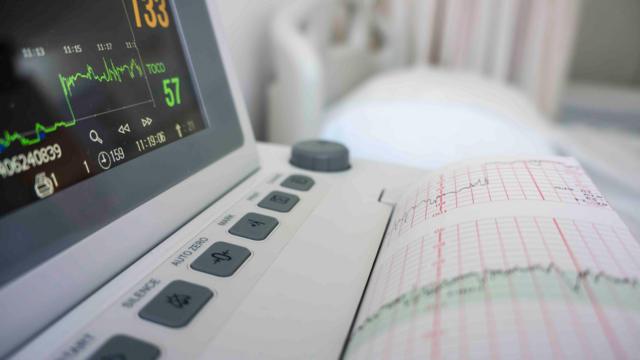 قياس ضغط الدم والنبض