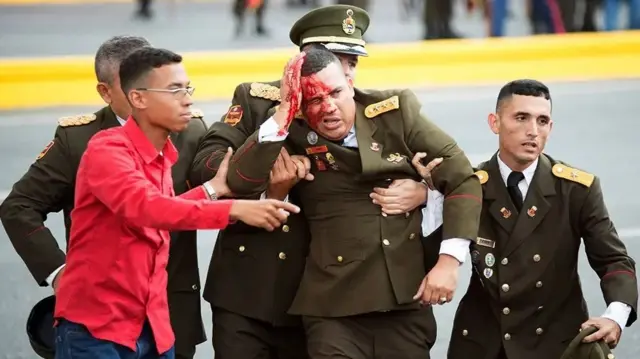 Askari ku dhaawacmay weerarka drones ee lagu qaaday madaxweynaha Venezuela