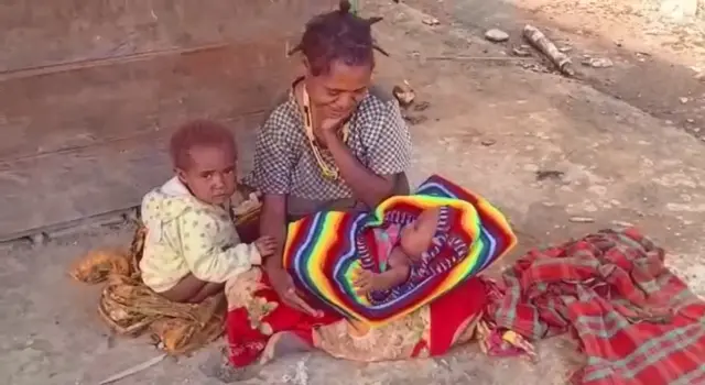 campak di Dogiyai, Papua Tengah