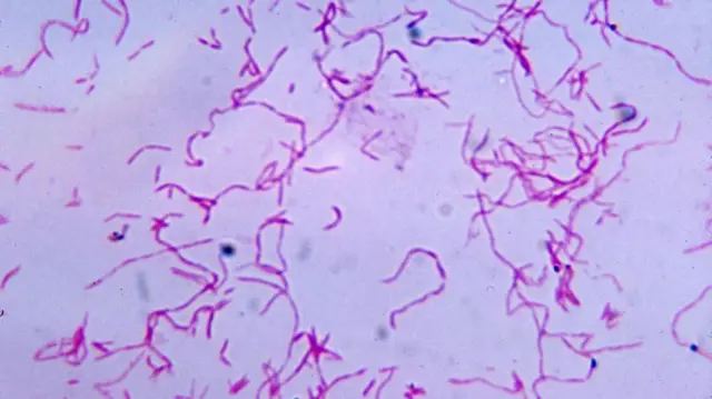 Fusobacterium nucleatum 
