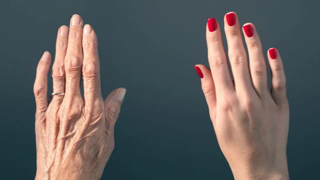 Imagem retrata duas mos: a esquerda com sinais de envelhecimento, e a direita, mais jovem, com as unhas pintadas de vermelho.