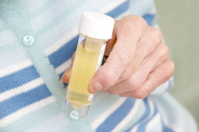 प्रतीकात्मक तस्वीर.