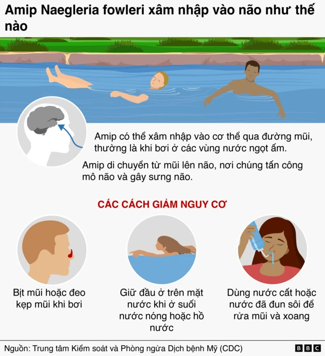 Amip ăn não