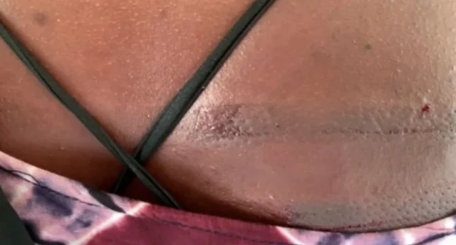 Foto show back of de woman dem flog