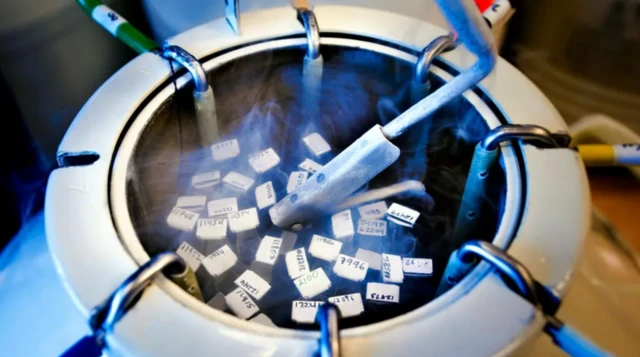 ਸ਼ੁਕਰਾਣੂ