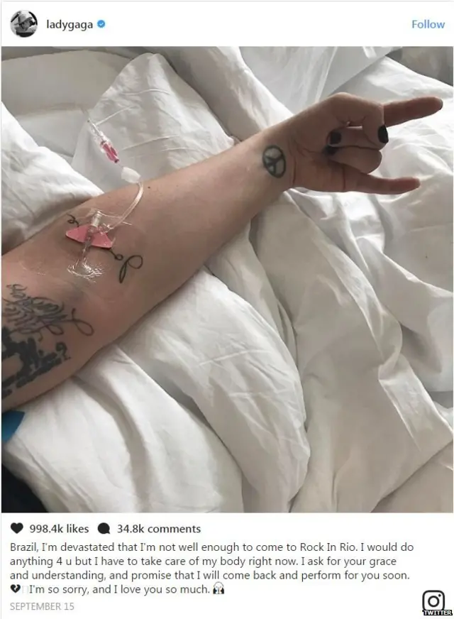 लेडी गागा, पॉप स्टार,सेहत, मांस पेशियों में दर्द, वर्ल्ड टूर