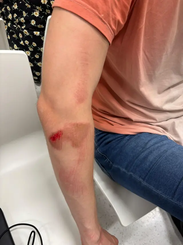 Povrede Matije Saba Vojnića zadobijene prilikom hapšenja