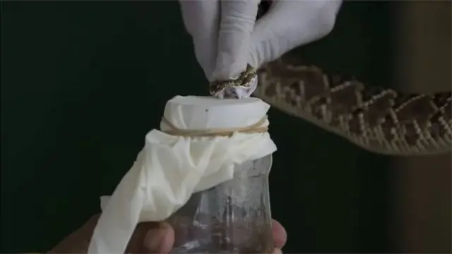 सर्पदंश