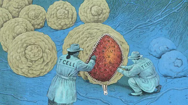 Ilustração de células T, com forma humana, abrindo o zíper de uma célula para revelar um tumor no seu interior 