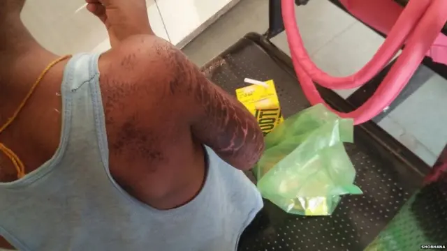 बच्चे, गोरापन, क्राइम