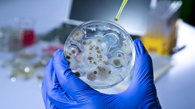 Placa de Petri con cultivo de ántrax