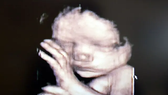 ஸ்கேனில் தெரியும் குழந்தை