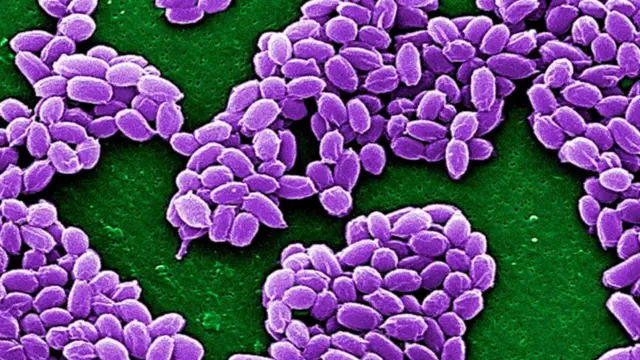 أدى ذوبان التربة الصقيعية في سيبيريا إلى إطلاق بكتريا "العصوية الجمرية" المُسببة لمرض الجمرة الخبيثة