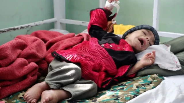 سازمان جهانی غذا هشدار داد که در سال ۲۰۲۵، صدها هزار کودک با سوءتغذیه مواجه خواهند شد