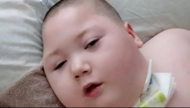 யுக்ரேனில் டார்ச் லைட் வெளிச்சத்தில் அறுவை சிகிச்சை செய்யும் மருத்துவர்கள் - என்ன காரணம்?