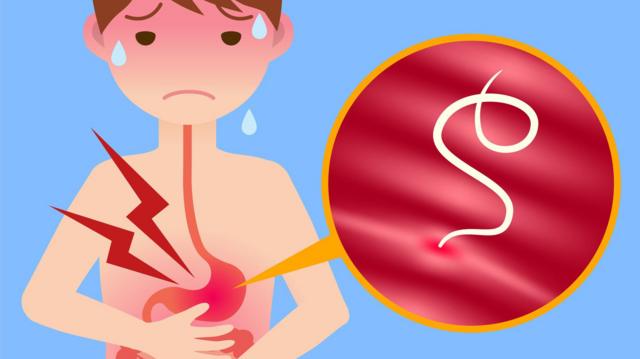 குடற்புழு வருவது எப்படி?