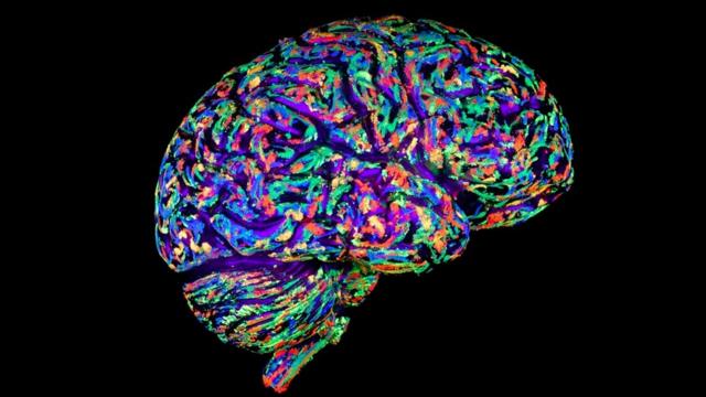 В крошечном мозгу, созданном Ланкастер и ее коллегами, содержится два миллиона нейронов - всего в два раза меньше, чем в мозгу мыши