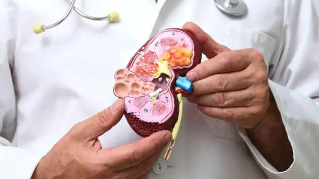 કિડની, કિડની ટ્રાન્સપ્લાન્ટ, આરોગ્ય