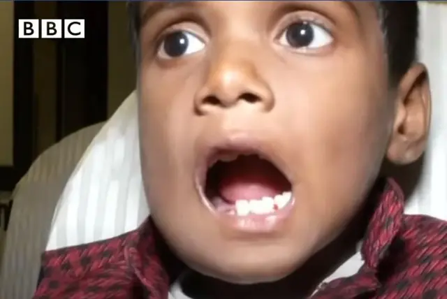 Nwata e wepụtara eze 525 n'ọnụ