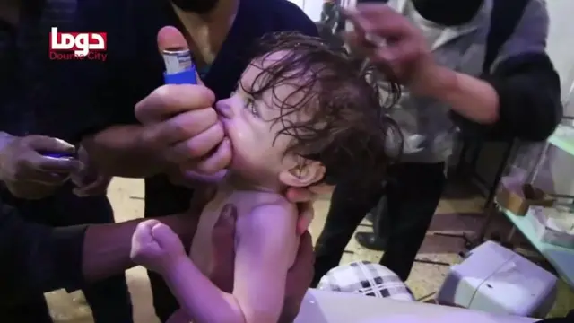 জরুরী চিকিৎসা দেয়া হচ্ছে একটি শিশুকে