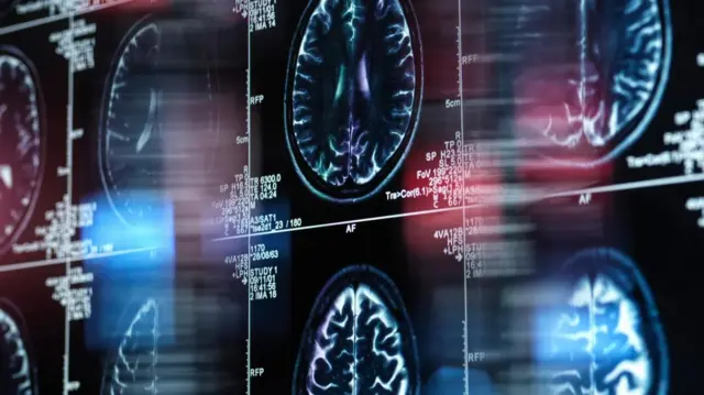 मेंदूचा स्कॅन 