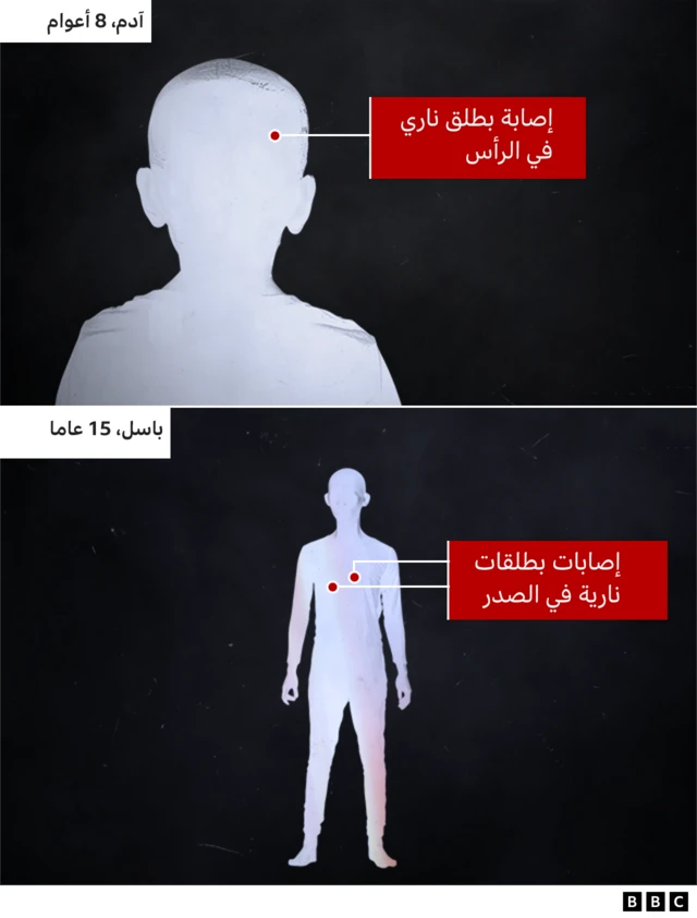 توضيح لإصابات آدم وباسل