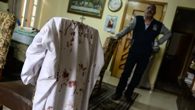 ملابس عليها دماء