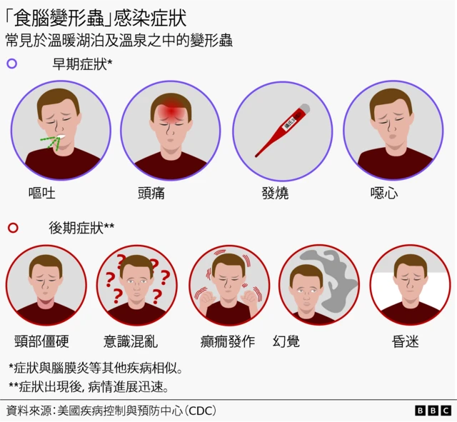 視覺新聞圖表展示感染症狀,包括:嘔吐、頭痛、發燒、噁心、頸部僵硬、意識混亂、癲癇發作、幻覺及昏迷。每項症狀均以圓形框中的人物圖像作視覺化呈現。