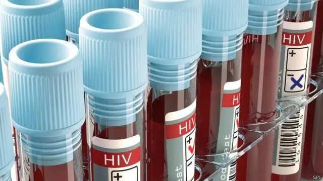 ஹச்ஐவி மற்றும் எயிட்ஸ்