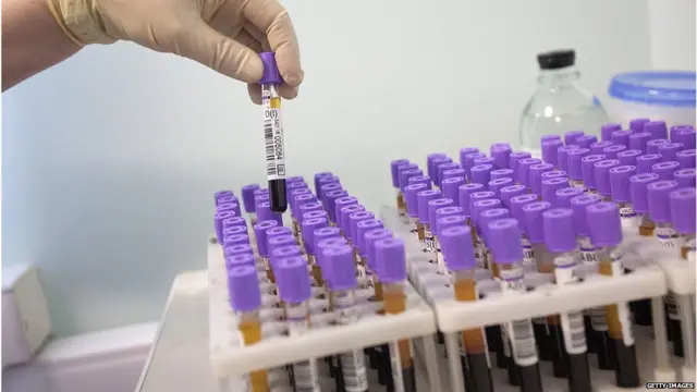 बॉम्बे ब्लड ग्रुप, रक़्तदान