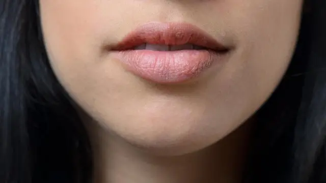 صورة لنصف وجه إحدى الفتيات