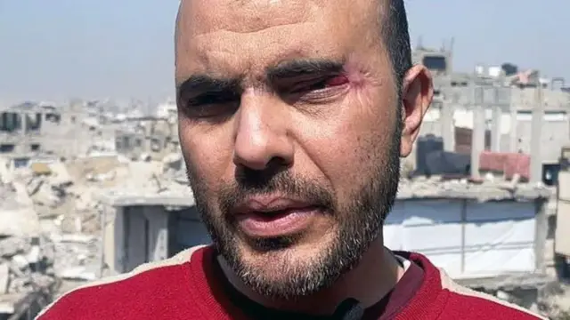 Daktari bingwa wa macho huko Gaza alithibitisha kuwa Abu Tawileh alikuwa ameunguzwa na kemikali jichoni, na kuharibu ngozi karibu nayo.