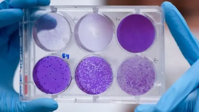 Virusi vya SARS na MERS vilitoa onyo kulingana na wataalam