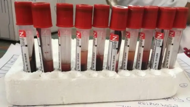 झिकावर औषधी