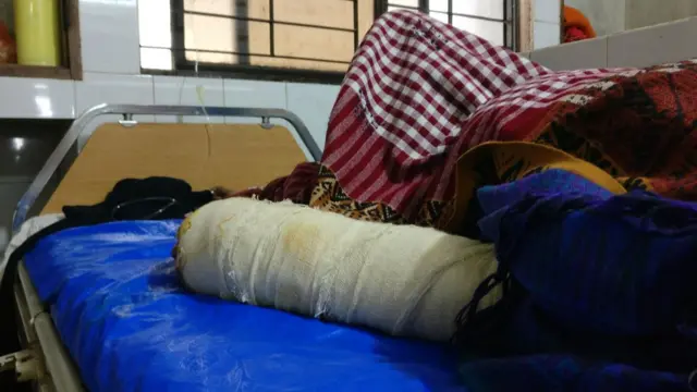 বৈদ্যুতিক শকে পুড়ে যাওয়া একজন