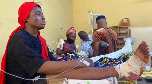 Nwaanyị merụrụ ahụ nọ n'ụlọọgwụ