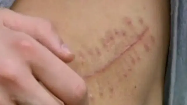 પ્રતીકાત્મક તસવીર