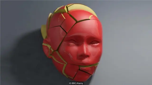 尽管偏头痛严重削弱患者的身心健康,一些专家仍不认为其是"真正的神经内科疾病"。