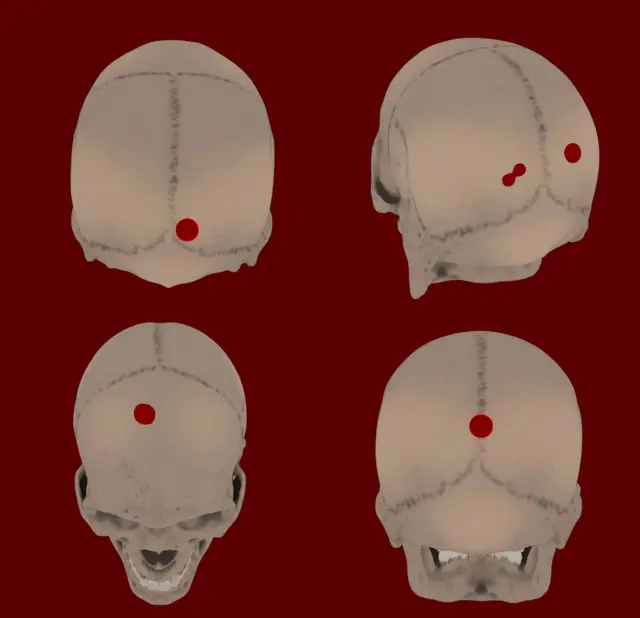 Diagramación de los cráneos encontrados con puntos que señalan los orificios