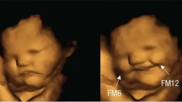 Sawir laga qaaday ilmo ku jira caloosha hooyadood