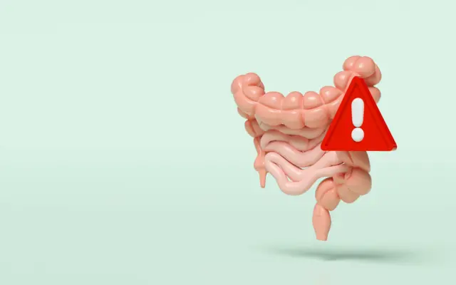 hemorrhoids Piles Rectal cancer constipation blood fissure fistula perianal abscess