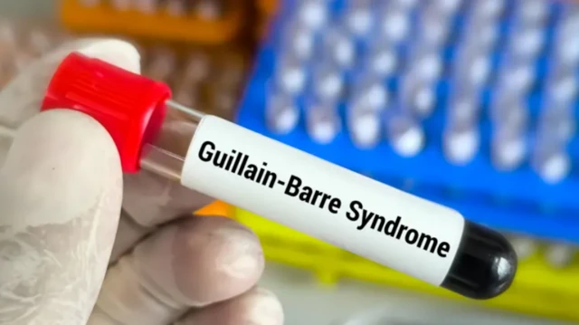 ਗੁਇਲੇਨ ਬੈਰੇ ਸਿੰਡਰੋਮ