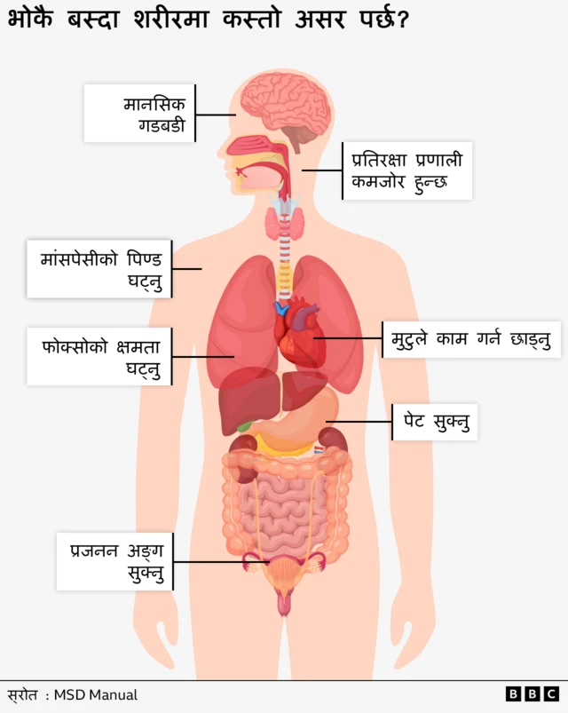 भोकै बस्दा शरीरमा कस्तो असर पर्छ?
