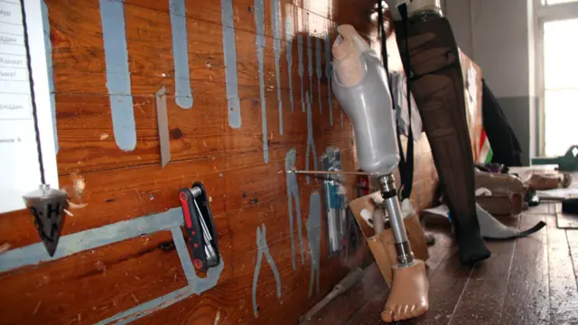 خدمات رایگان کارخانه اورتز و پروتز شهر دوشنبه