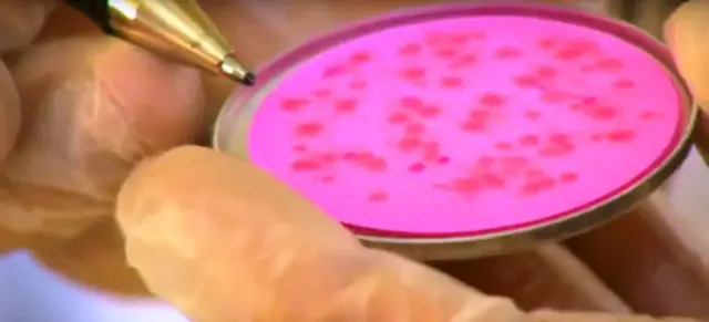 څېړنې ښيي، د کابل په ۱۰۰ ملي لیترو اوبو کې ۲۰ مضرې باکتریاوې شته