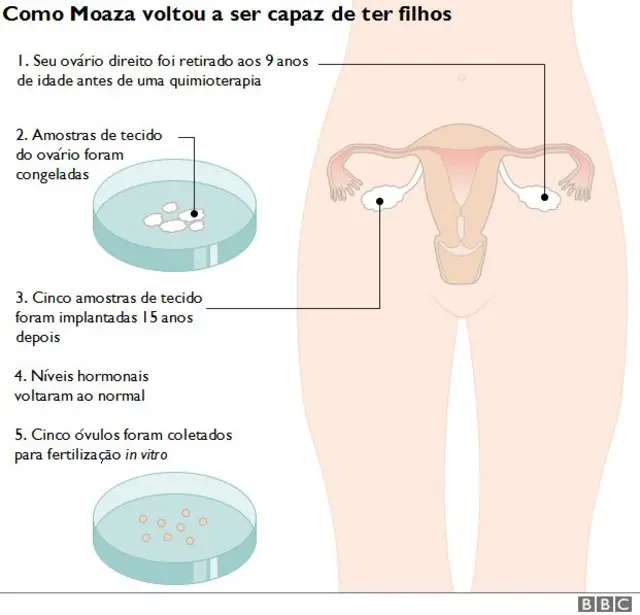 Gráfico mostra o procedimento aplicadoprobabilidade roleta cassinoMoaza