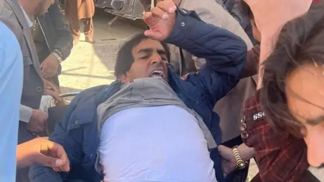 پر خواله رسنیو خپرو شویو تصویرونو کې محسن دوړ په ټپي حالت کې لیدل کېږي.